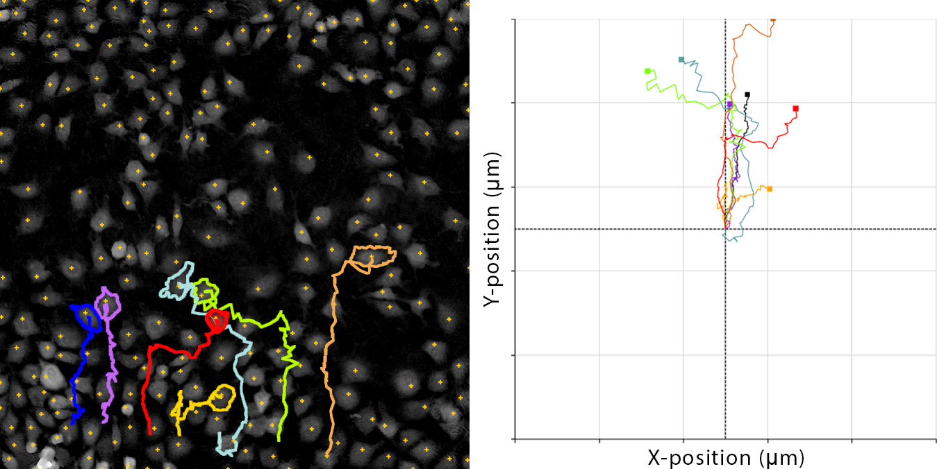 Wound Healing Assay Single Cell Migration HoloMonitor