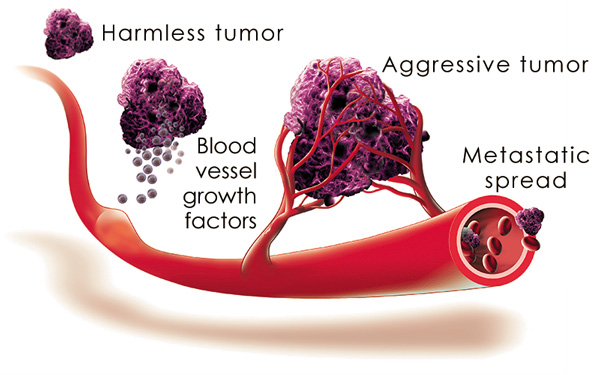 Angiogenesis