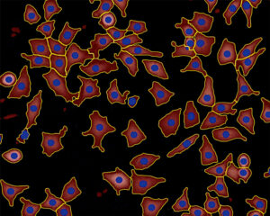 Segmentation of cells in a quantitative phase image Segmentation of cells in a quantitative phase image