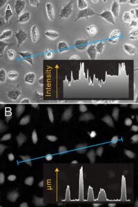 Quantitative phase imaging vs. phase contrast Quantitative phase imaging vs. phase contrast