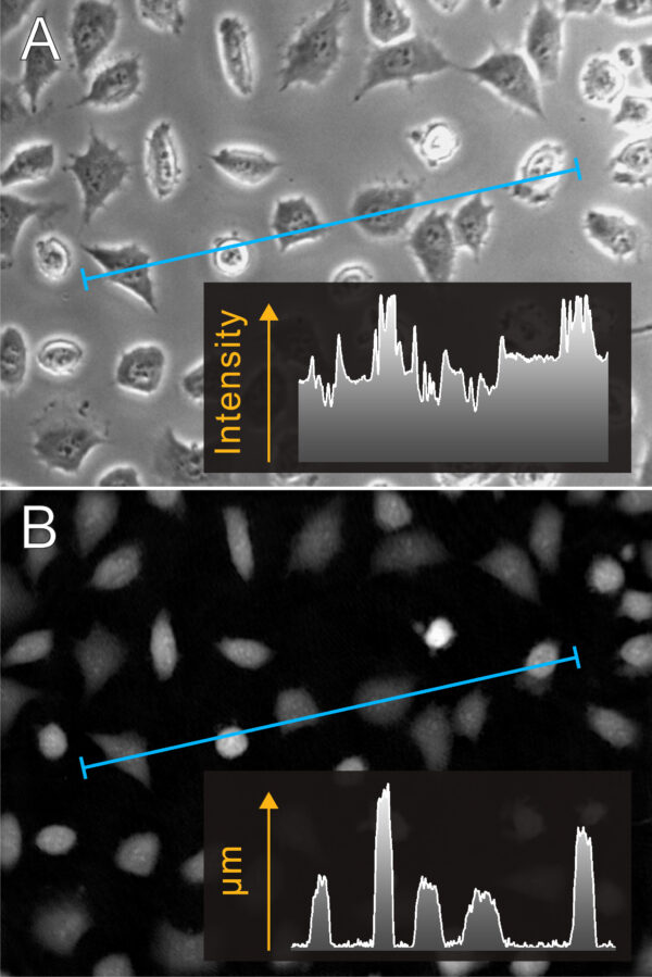 Quantitative Phase Imaging - PHI