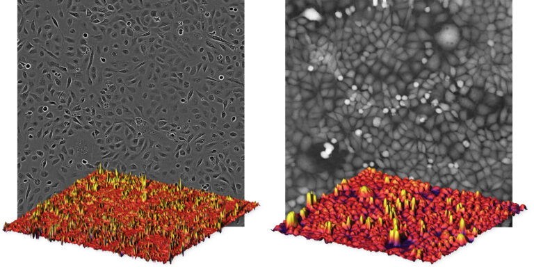 Phase contrast vs. quantitative phase microscopy In quantitative phase microscopy images cells appear as peaks