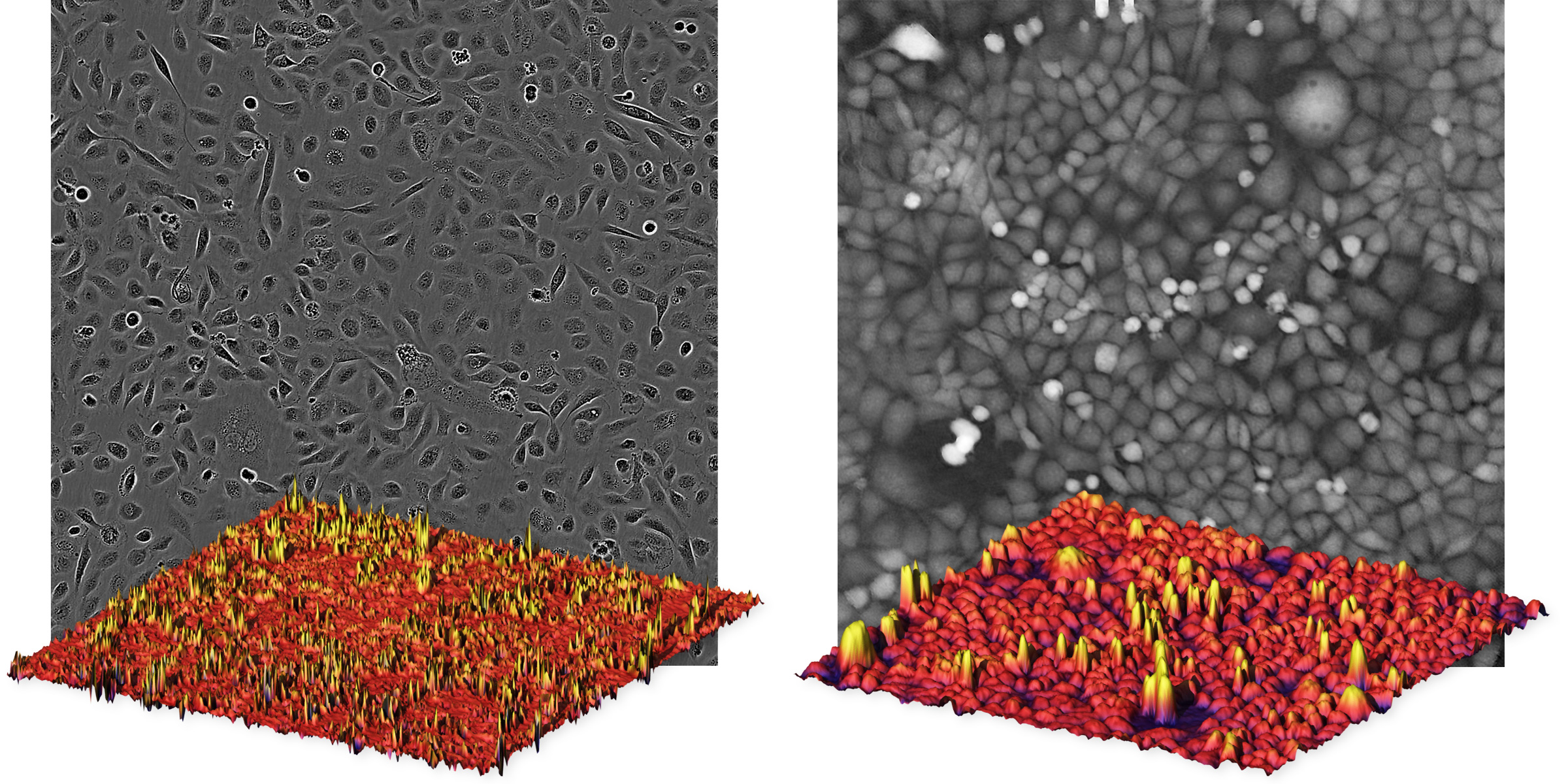 Phase contrast vs. quantitative phase microscopy In quantitative phase microscopy images cells appear as peaks