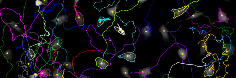 Cell Tracking Banner