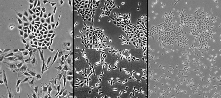 Epithelial-mesenchymal Transition