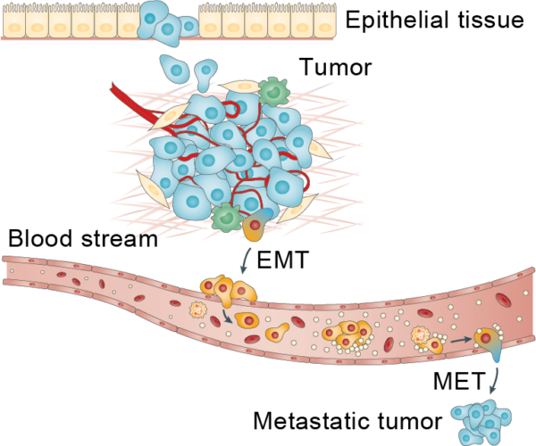 Epithelial-mesenchymal Transition - Huntsman Cancer Institute - Phi