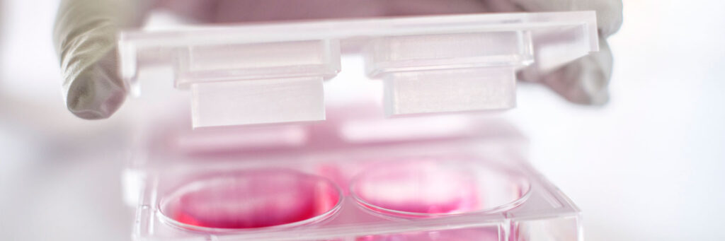 The HoloMonitor HoloLids are specially designed to eliminate image disturbances, caused by surface vibrations and condensation inside the cell culture vessel.