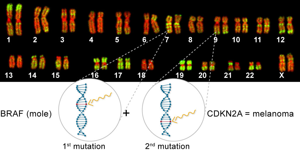 BRAF Mutation