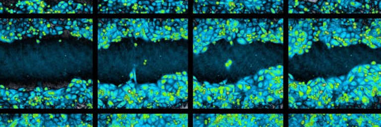 Wound Healing Banner A wound healing time-lapse image sequence of a wound healing scratch assay, acquired by holographic time-lapse microscopy using the HoloMonitor imaging cytometer.