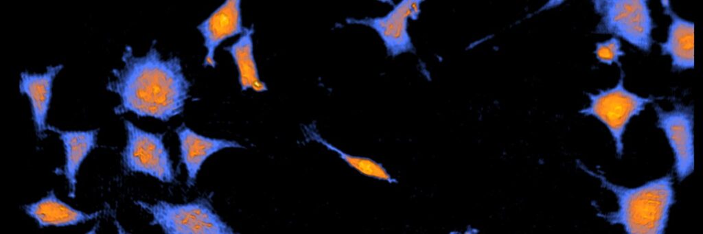 Live Cell Assays - PHI