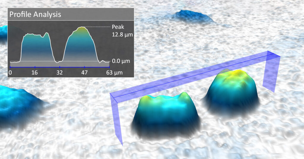 live cell imaging analysis