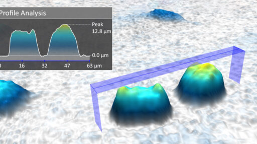 live cell imaging analysis