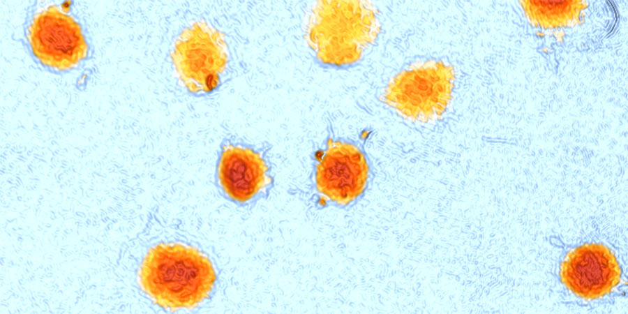 Large, orange cells in G2 arrest on light blue background.