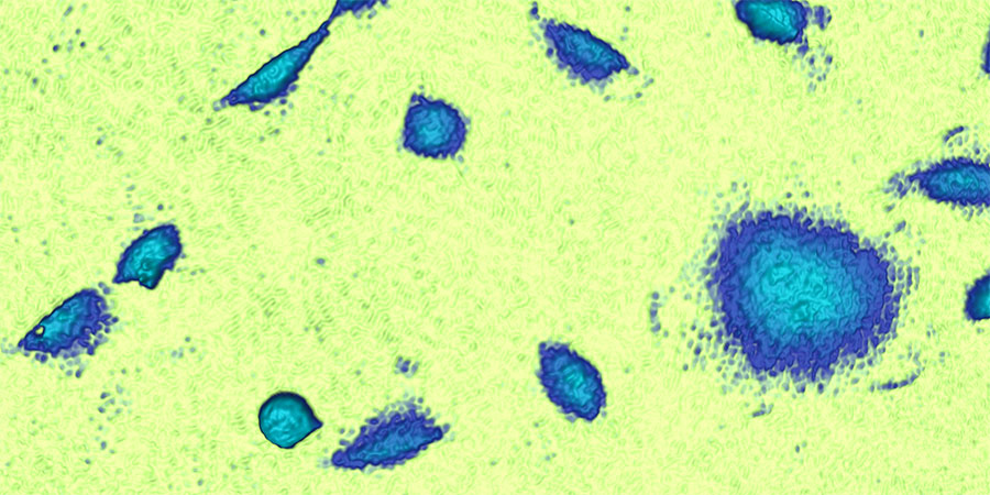 Blue A549 cells on a bright green background. The cells show different morphologies.