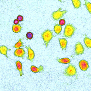 Top view of yellow L929 cells on a bright blue background