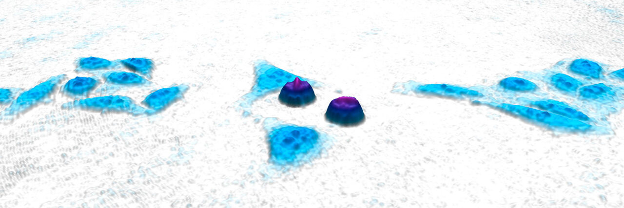 Radiology report for denna martinez essay 06 picture