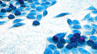 Blue cells on white background showing a closing cell gap of a wound healing assay