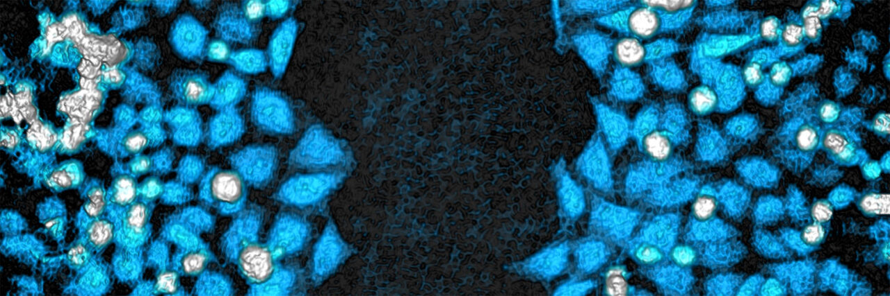 Scratch wound assay principle image