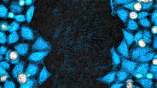 Blue cells on black background showing a wound healing scratch, with cells to the left and right.