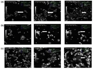 drug discovery live cell imaging