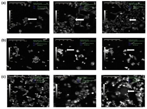 drug discovery live cell imaging