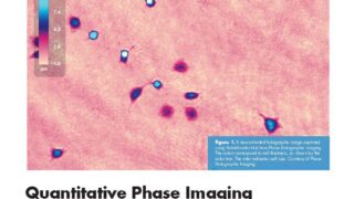 BioPhotonics-article-QPI-regenerative-medicine-cover