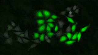 Green fluorescent cells on a black background.