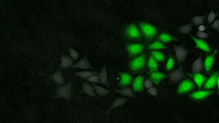 Green, fluorescent cells on a black background.