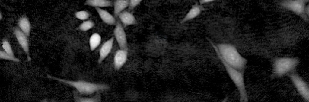 White and grey cells on a black background.